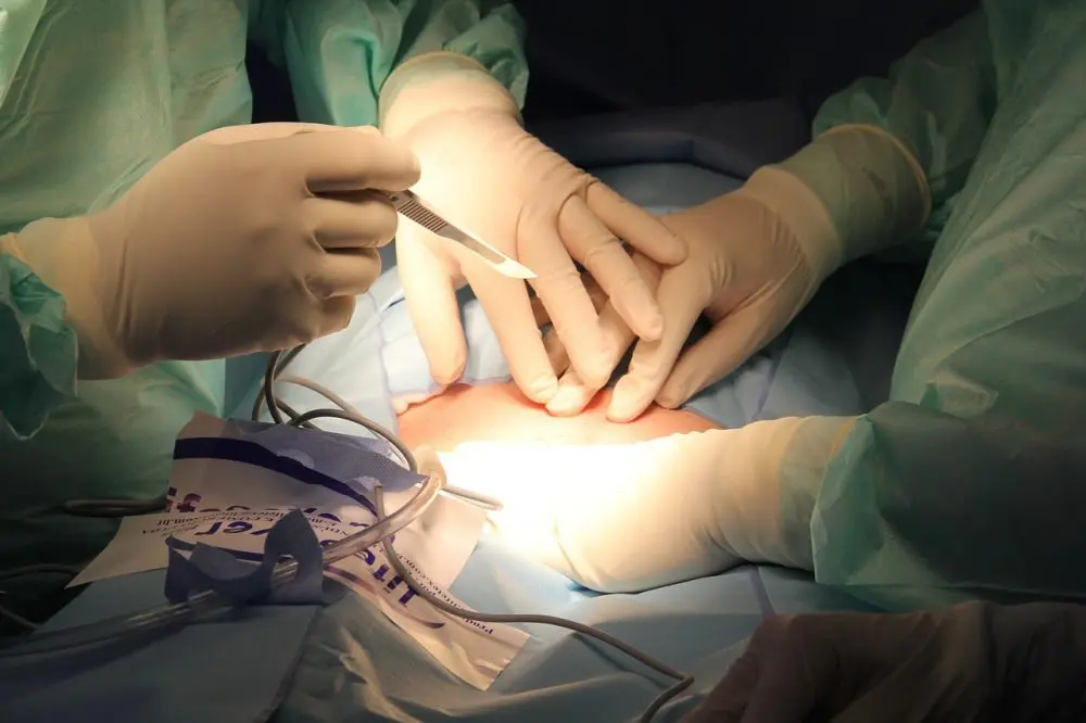 die casting medical equipment